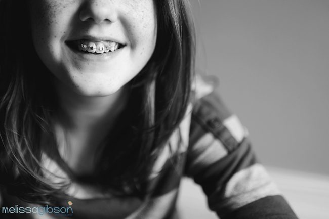 black and white image of child smiling with braces unique photography style